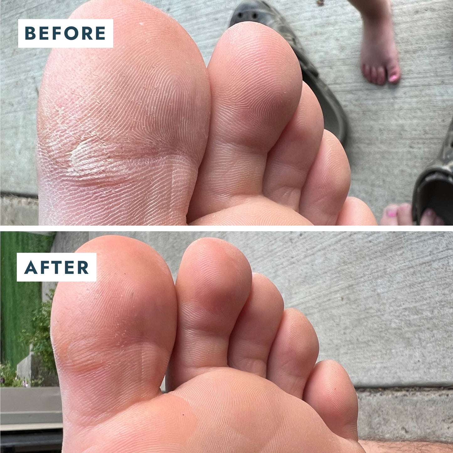 Heel Repair Duo Retail - Mint