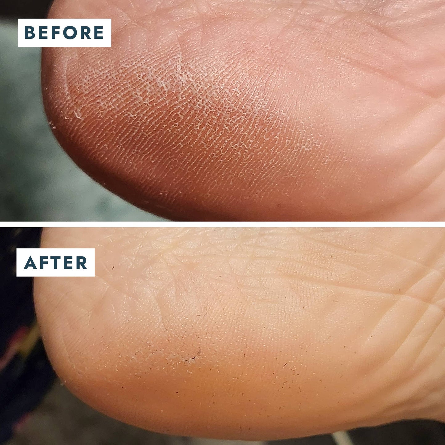 Heel Repair Duo Retail - Mint