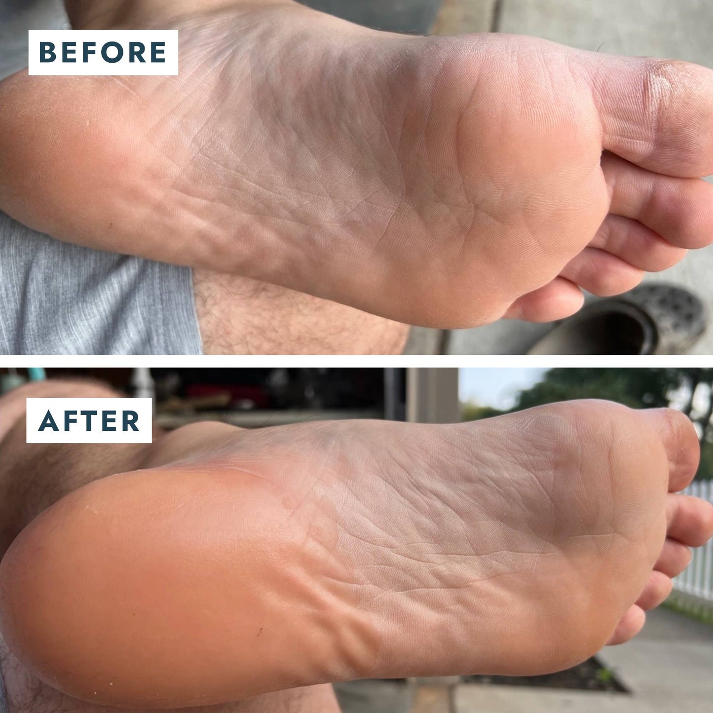 Heel Repair Duo Retail - Mint