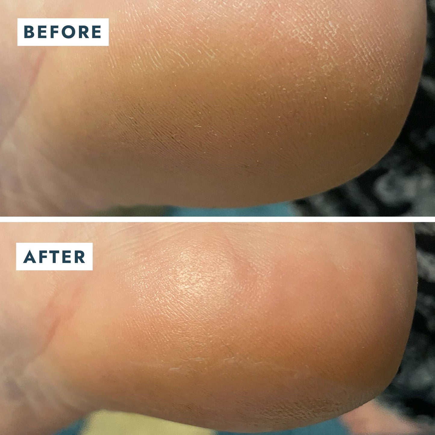 Heel Repair Duo Retail - Mint