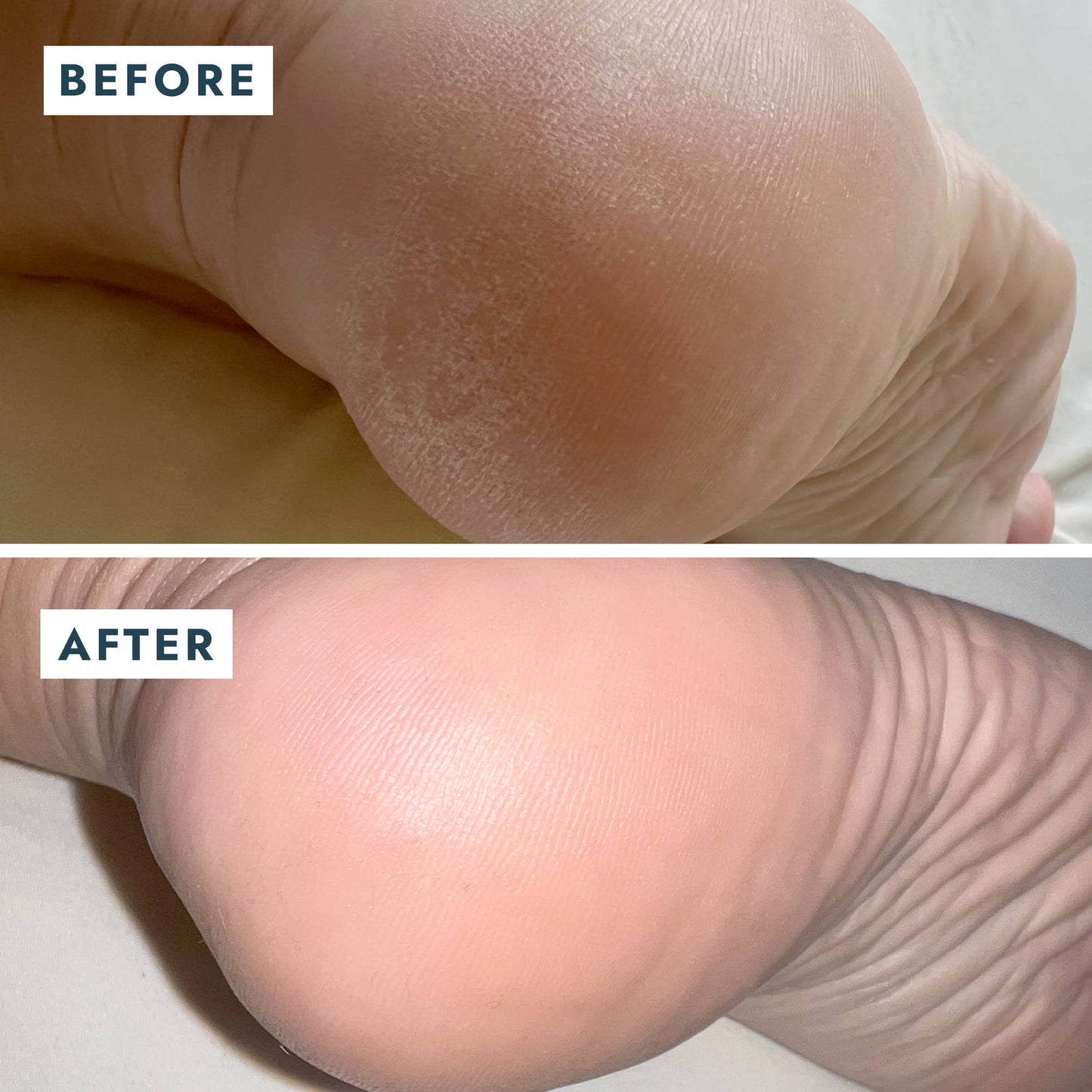 Heel Repair Duo Retail - Mint